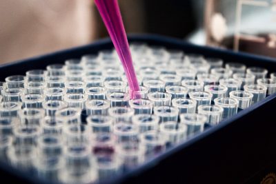 Why HPLC Purity Testing Matters for Research Peptides